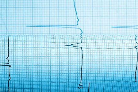 TGS announces onshore 3D seismic survey in the Powder River Basin